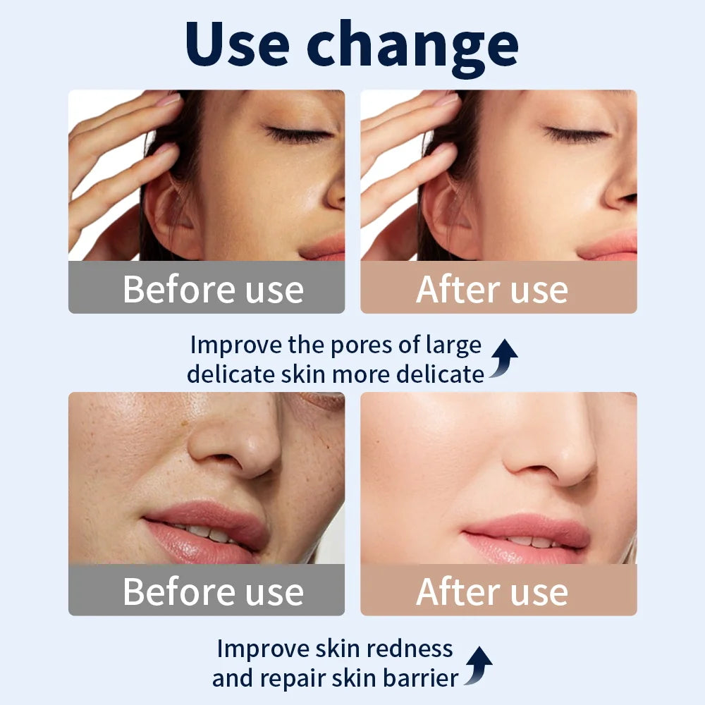 LED Face Mask for Skin Rejuvenation and Acne Treatment