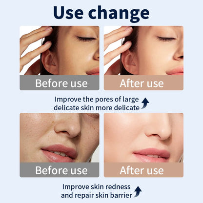 LED Face Mask for Skin Rejuvenation and Acne Treatment