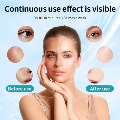 LED Face Mask for Skin Rejuvenation and Acne Treatment